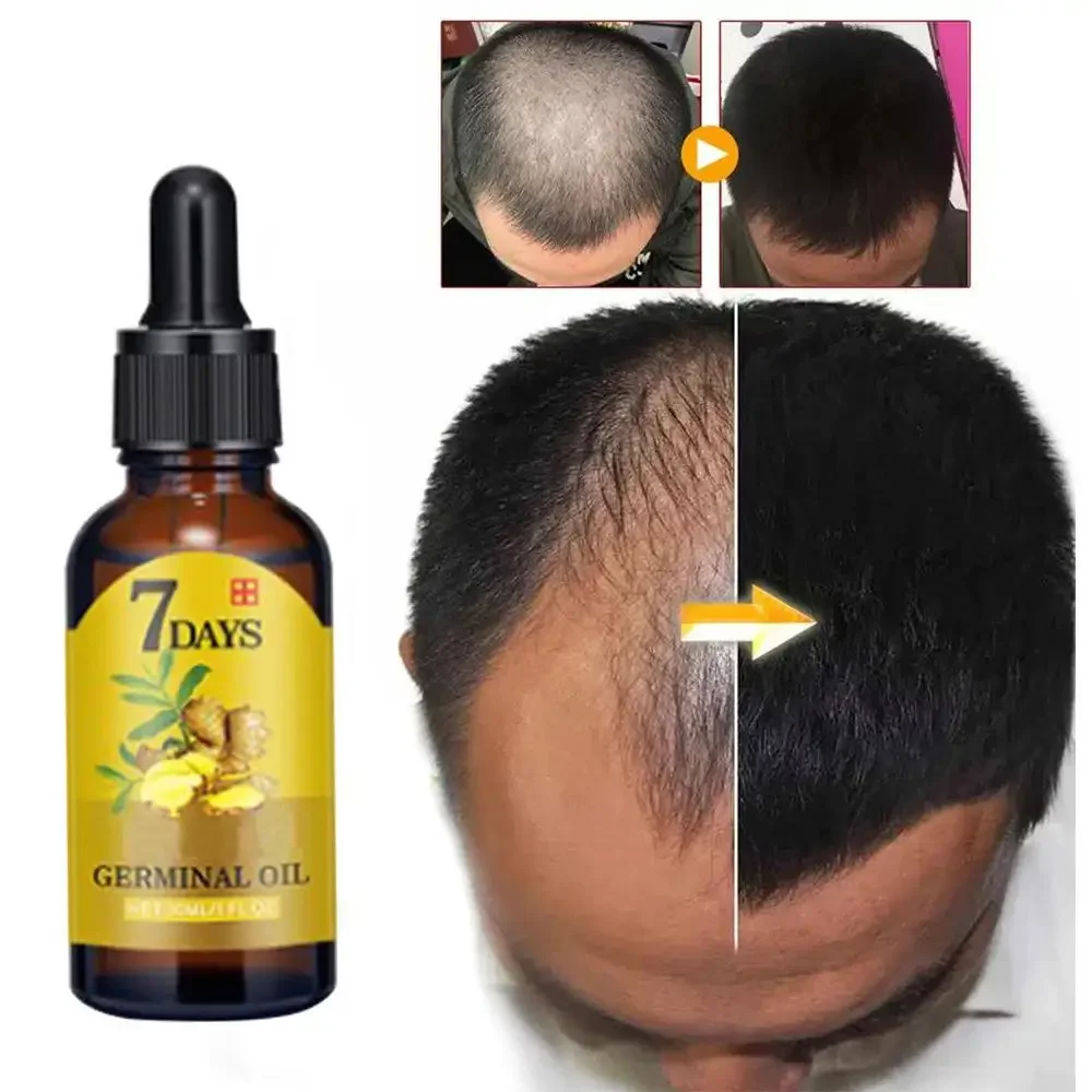 Ingrown Hair Serum - Имбир для роста волос, эфирное масло