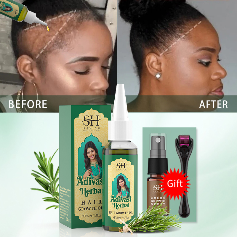 Аюрведическое масло для роста  – обзор и цена Ingrown Hair Serum