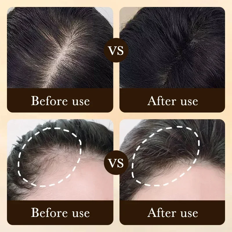 Биотиновое масло для быстрого  – обзор и цена Ingrown Hair Serum