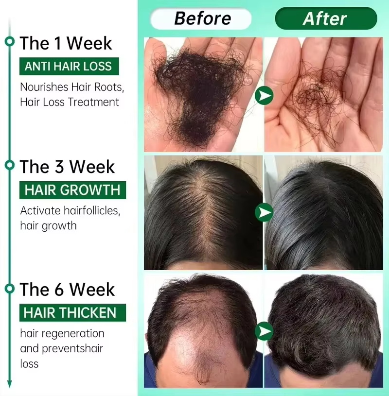 Сыворотка для роста волос: Быс – обзор и цена Ingrown Hair Serum